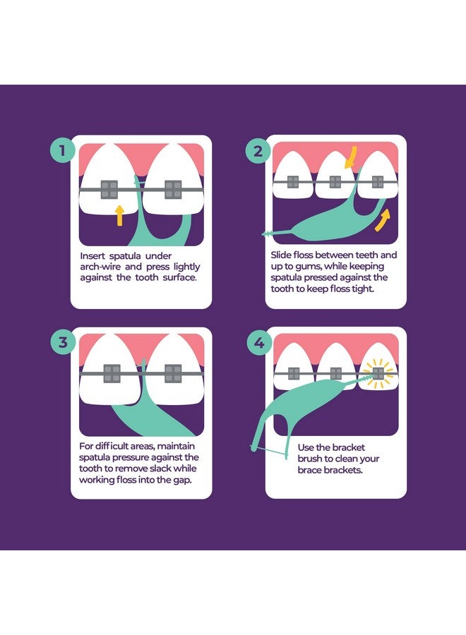 Platypus Orthodontic Flossers for Braces | Ortho Picks for Adults & Kids | Fits Under Arch Wire | Non-Damaging | Encourage Flossing Habits | Floss Teeth in Less Than Two Minutes | 40 Count (Pack of 1) - Image 3