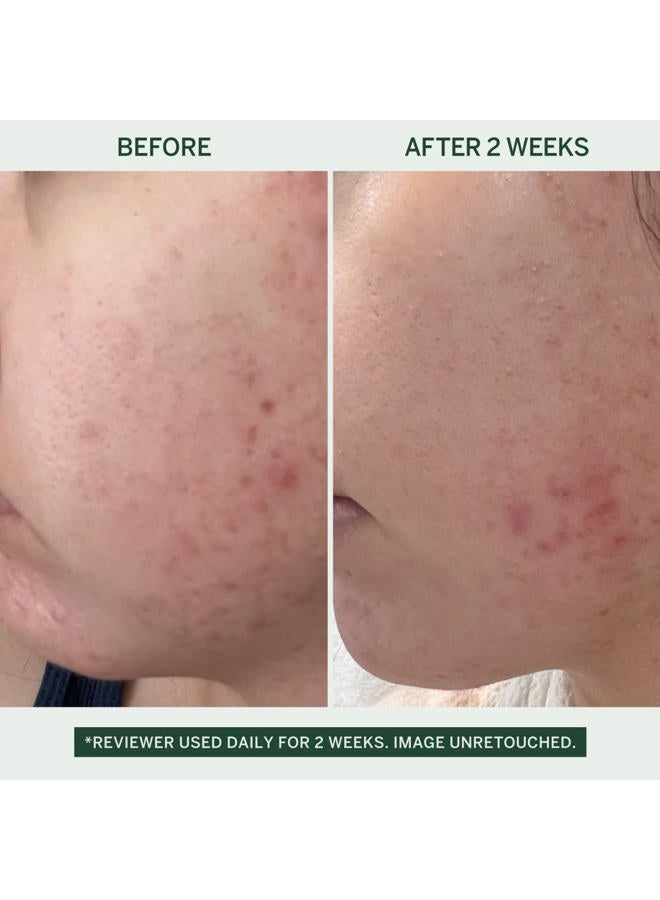 FACETORY Urban Calm Hydrating Vita Serum - Glow Boosting Facial Serum with Fermented Mung Bean & 10% Niacinamide for Fine Lines & Wrinkles - Plump & Revive Dry Skin - Smoothing & Calming - 30ml / 1.01 fl oz - Image 2