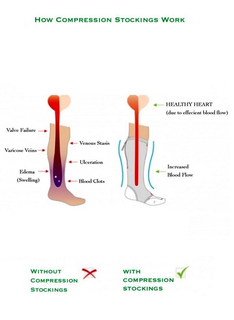 Venosan 100 Thigh level Medical Compression Stocking Class II (23 - 32 mmHg) Skin Tone VM12604, Size X-Large
