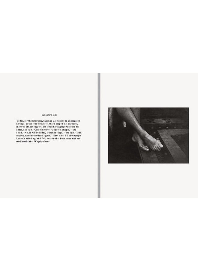 Hervé Guibert: Suzanne and Louise