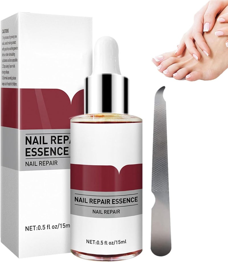 Nail Repair Essence Fungal Nail Treatment For Toenails Extra Strong Extra Strong Nail Fungus Treatment for Toenail Fingernail Toenail Care Solution
