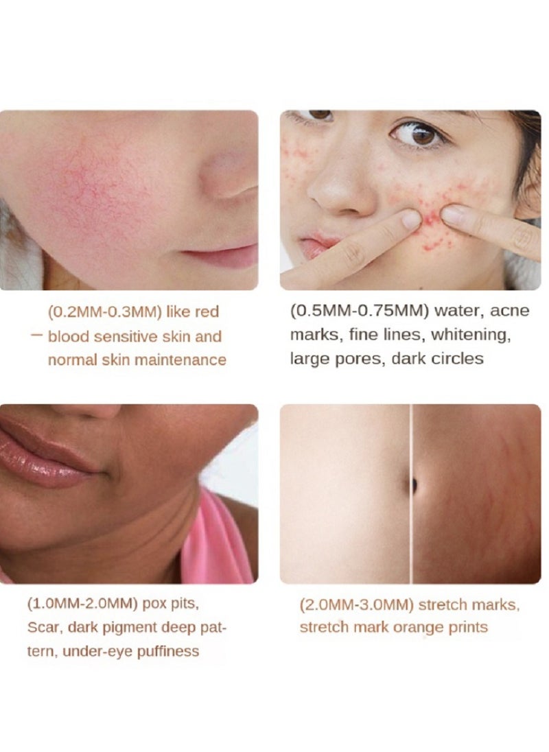 هايدرا - DRS 140 0.75mm الفولاذ المقاوم للصدأ إبرة Derma طوابع الأسطوانة - Image 1