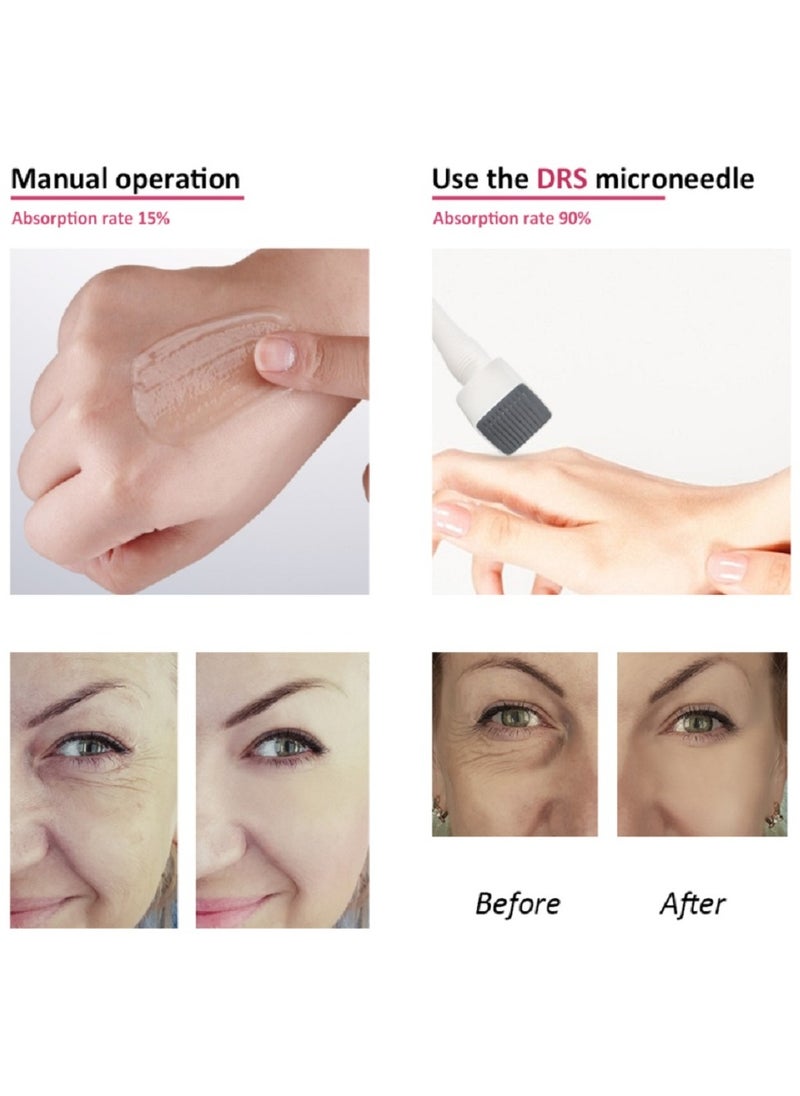 هايدرا - DRS 140 0.75mm الفولاذ المقاوم للصدأ إبرة Derma طوابع الأسطوانة - Image 1