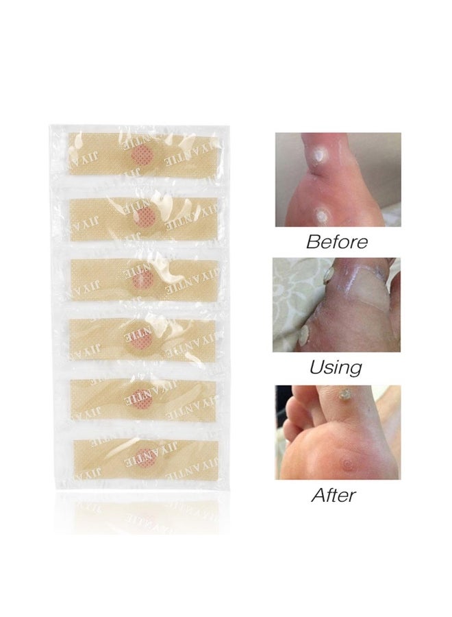 Generic Foot Medical Corn Remover Plaster Patch Feet Callus Removal Care Tool 