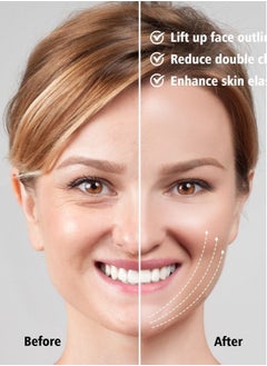Generic EMS Facial Lifting Device - LED Photon Therapy for Face Slimming, Vibration Massager for Double Chin, V Line Lift Belt, Cellulite Jaw Device  - Image 5