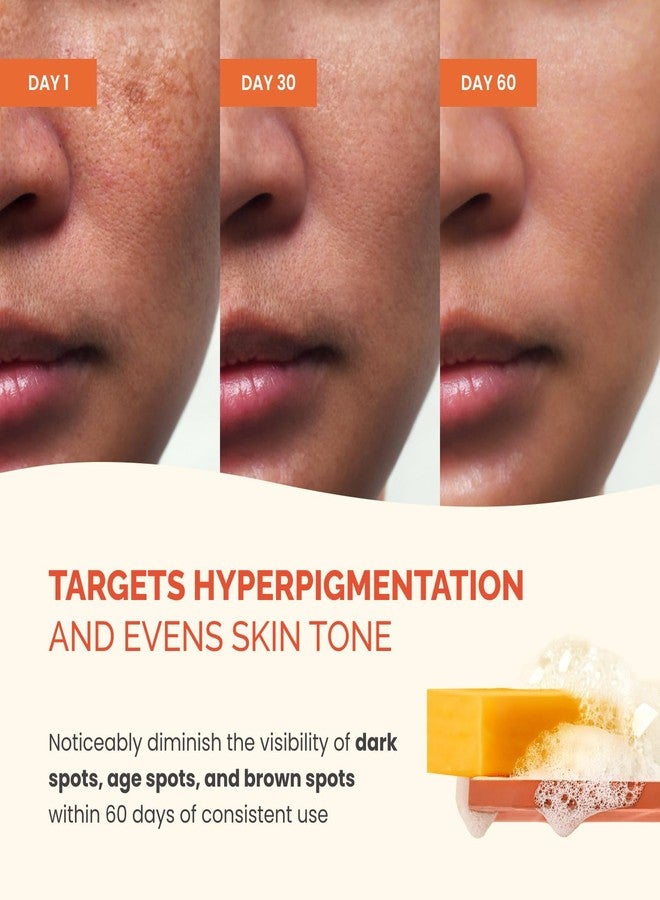 PLANTIFIQUE Kojic Acid Soap for Hyperpigmentation - Turmeric Soap Bars with Hyaluronic Acid, Collagen & Vitamin C for Dark Spots - Face & Body Wash for Women & Men, Vegan Skincare, 320g/11.28 oz - Image 5