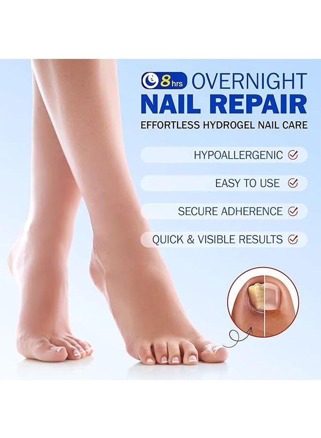 Elaimei Fungal Nail Repair Patches，Overnight Nail Repair Treatment for Nail Discoloration & Cracked Nails, Restore Healthy Nail Appearance，Overnight Nail Repair Patch-21  Patches - Image 2