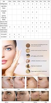 Derma Roller 05mm Beard Roller Titanium Micro Needling Roller for Men and Women 540 05mm Titanium Needles Beard Growth Roller for Stimulate Hair Growth Facial Skin Care Scar Removal - Image 5