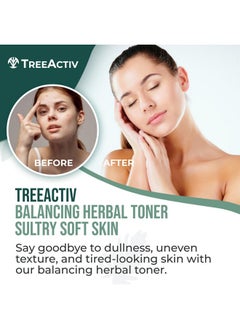 TreeActiv TreeActiv Balancing Herbal Toner, 4 oz, Witch Hazel Toner for Face with Rose Water, Clary Sage Water, and Tea Tree Water, Facial Toner for Oily Skin and Acne-Prone Skin, Hydrating Toner for Face  - Image 2