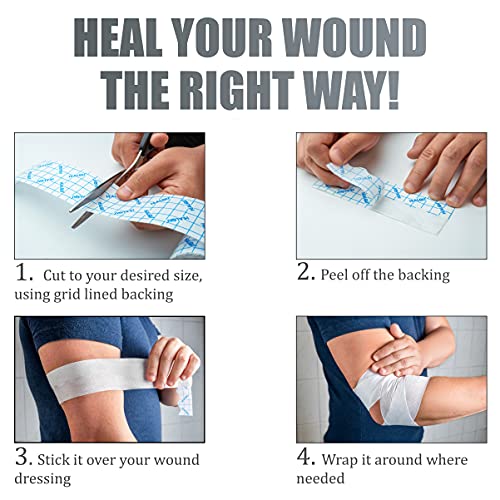 HEALQU Dressing Retention Tape - 2" x 11yd, 2 Rolls Premium Non-Woven Hypoallergenic Cloth - Secure and Gentle Adhesive for Wound Dressings - Latex-Free and Versatile for Sensitive Skin Care - HEALQU - Image 5