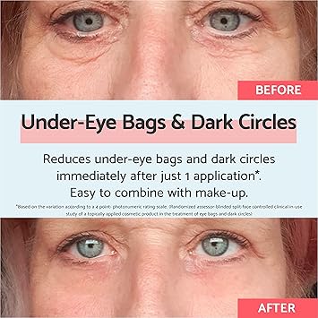 Remescar Eye Bags Dark Circles 8ml Instant Dark Circle Eye Cream for Under Eye Bags and Remove Bags Under Eyes Eye Bag Remover In Only 2 Minutes 180 Applications - Image 2