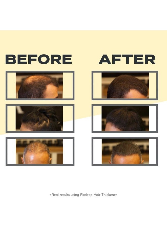 FIXDEEP Hair Thickener | New Waterproof Formula - Natural & Fuller Looking Hair in 30 sec - 14g - Hair Fibers for Thinning Hair & Bald Spots & Graying Hair Roots (Medium Brown) - Image 2