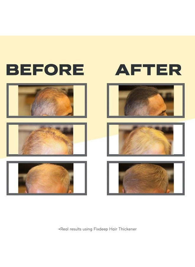 FIXDEEP Hair Thickener | New Waterproof Formula - Natural & Fuller Looking Hair in 30 sec - 14g - Hair Fibers for Thinning Hair & Bald Spots & Graying Hair Roots (Medium Brown) - Image 3