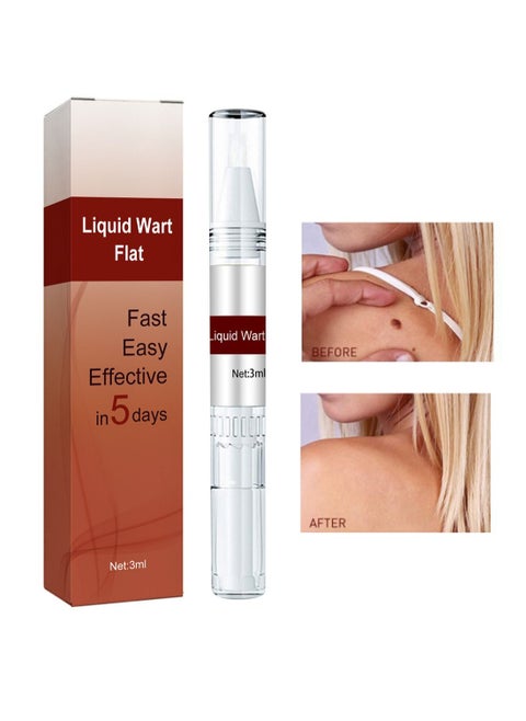 Liquid Wart Flat, Wart Remover Easy to Use Fast Effective Painless Natural Safe Suitable for All Skin Types 1 Pcs