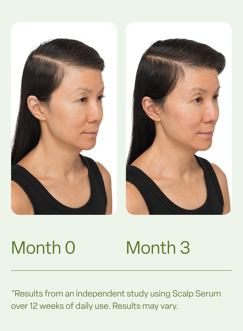 ديفي مصل فروة الرأس لترقيق الشعر، 30 مل – اختبار سريري، صيغة مغذية مع الأحماض الأمينية، الكافيين وزيت الروزمري – يعزز فروة الرأس الصحية والشعر الأكثر ملاءمة، يقلل من تراكم الزيت والمنتج - Image 5