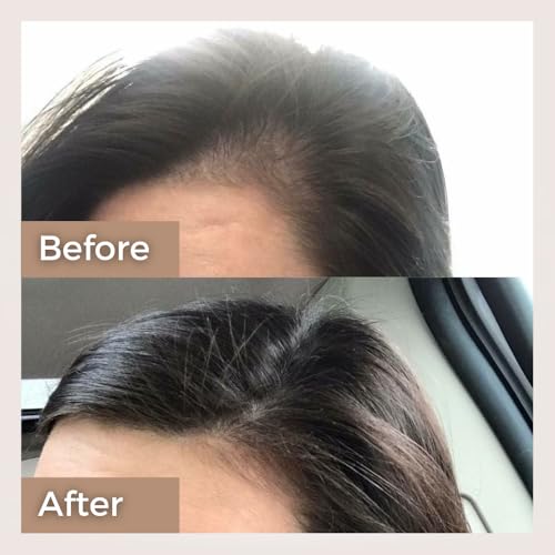 The Tribe Concepts Onion Hair Oil For Hair Growth & Hair Fall Control With Almond And Coconut Oil, 100 ml, Pack of 1 - Image 5