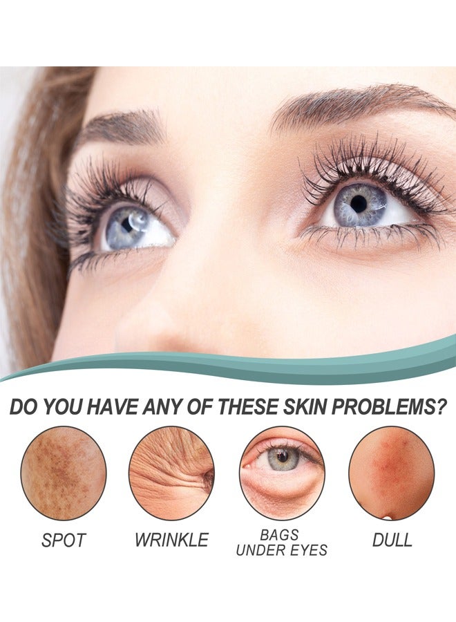 EELHOE Dark Spot Corrector Remover Cream 30g, Improve Skin Moisture, Repair The Skin Barrier, and Reduce The Impact of Ultraviolet Rays On The Skin, Suitable For All Types of Skin, Make Skin Look Brand New - Image 2