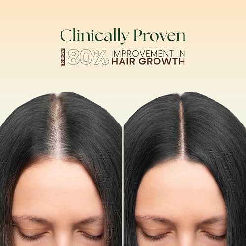 Moha 5-In-1 Ayurvedic Hair Oil with Blend of Rosemary, Coconut, Argan, Jojoba & Almond for Improvement in Hair Growth & Reductiond in Dandruff | Ayurvedic Hair Oil for Hair Loss, Breakage, Frizzy & Hair Thinning | Add Shine, Softens Hair, Damage Protection, Non-Sticky, Lightweight & Strengthening | Clinically Proven for 63% Reduce in Hair Fall - 100 Ml (Pack of 1) - Image 3