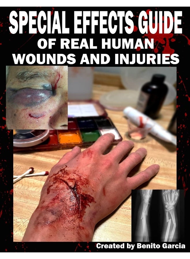 CREATESPACE Special Effects Guide Of Real Human Wounds and Injuries: Special Effects Guide Of Real Human Wounds and Injuries 