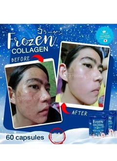 Frozen Collagen 2 In 1 Whitening 10X Premium Collagen Peptide 30000 Mg And L- Glutathione 10000 Mg 60 Tablet - pzsku/Z27E66B0411BABB1F9C22Z/45/_/1725429475/3b35faa9-b21e-4bd9-a66e-fcdf5f03780b