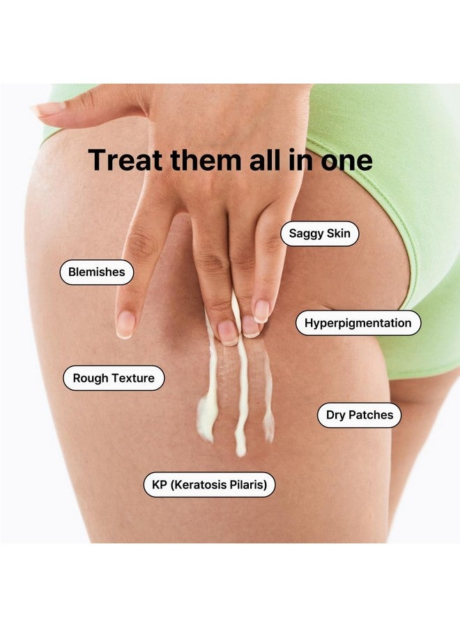 BY WISHTREND Vitamin A-mazing Bakuchiol Body Lotion 150g, Korean body lotion, skin bumps, chicken skin, hyperpigmentation, dull wrinkles, pore care for All Skin Types - Image 3