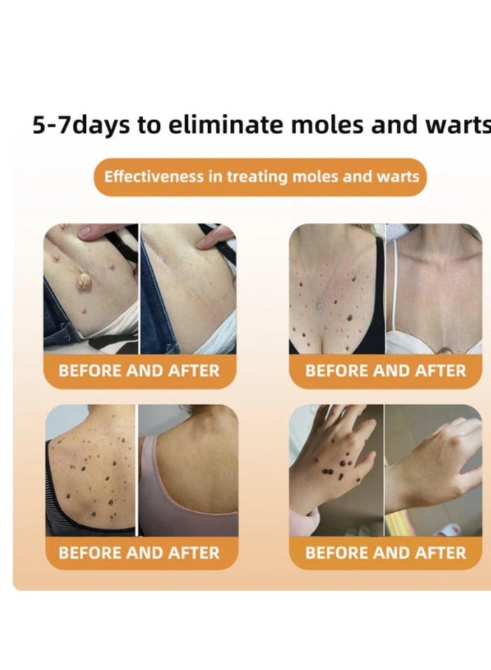 PHANSTA Venom Treatment Cream, New Professional Bee Venom Repair Cream, Bee Venom Cream for All Parts of The Body (1 Pack) 2024 New Bee Venom Treatment Cream - Image 4