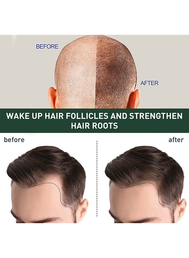 East Moon 7 Days  Hair Growing Serum , Rapid Growth Hair Treatment, Anti Hair Loss Hair Regrowth Essence, Nourishing Hair Care Essential Oil-30ml  - Image 4