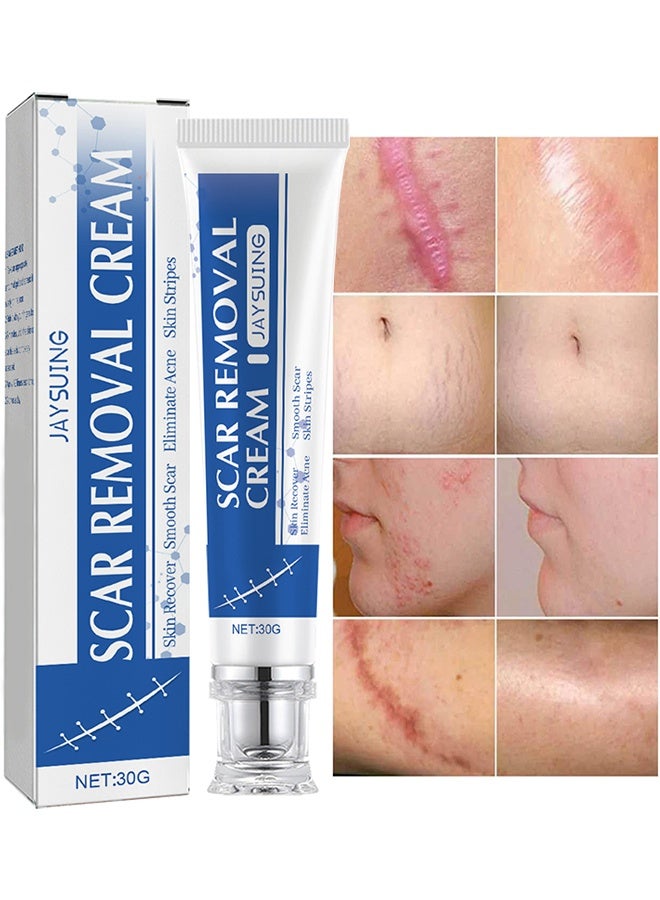 جايسوينغ كريم إزالة الندبات، كريم إزالة الندبات عالي الجودة، علاج ندبات حب الشباب، إزالة ندبات حب الشباب العميقة، ندبات الحروق وفرط النمو، إصلاح الجلد التالف، كريم علامات التمدد وندبات الجراحة، إزالة آثار حب الشباب وكريم تصحيح الندبات، 30 جم - Image 1