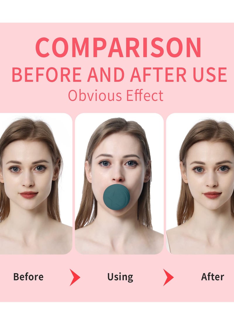 SOLARAE Jawline Exerciser, Face Neck Jaw Toning Double Chin Reducer, Facial Blowing Exercisers Enhance Firming Lifting Jaw Facial V Shape Lines Define Your Jawline (2 Pack) (Green) - Image 2