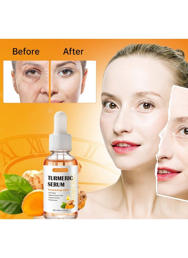 Kurchugo - Turmeric Serum for Dark Spots 1 Fl Oz, Turmeric Dark Spot Corrector Serum for Face & Body, Anti Aging Facial Serum for Women and Men, Reduces Hyperpigmentation, Age Spots, Sun Spot, Improve Skin Tone - Image 1