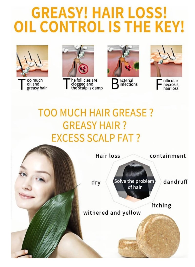 Nicimisey - Ginger Hair Regrowth Shampoo Bar,Anti-Hair Loss Hair Natural Organic Ginger Shampoo Bar, Ginger Bar Shampoo Soap Promotes Hair Growth Cleansing, Treats Dry and Sensitive Scalp - Image 1