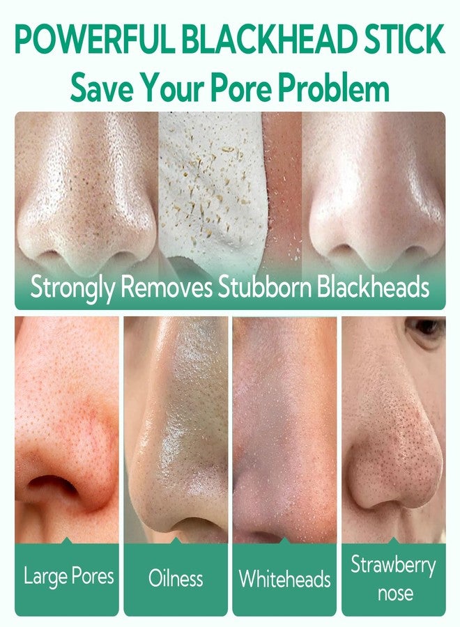 Breylee قناع بريلي لإزالة الرؤوس السوداء، شرائط أنف زيت شجرة الشاي +100 ورقة، نقاط سوداء، قناع تقشير للأنف والوجه، منظف مسام، تصميم فرشاة - Image 3