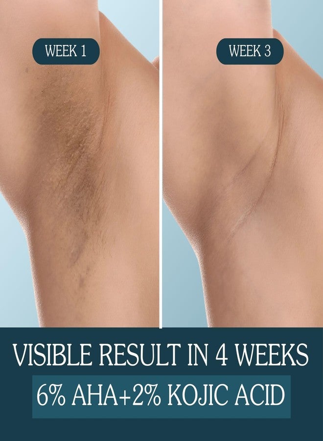 BAKE 6% AHA Underarm Roll On with 2% Kojic Acid, 3% Niacinamide | Brightening Underarm Roll On Serum | For Dark Underarms, Elbows, Knees, Odour & Sweat | Brightening & Exfoliating Serum for Dark Underarms | For Women & Men - 50ml - Image 4