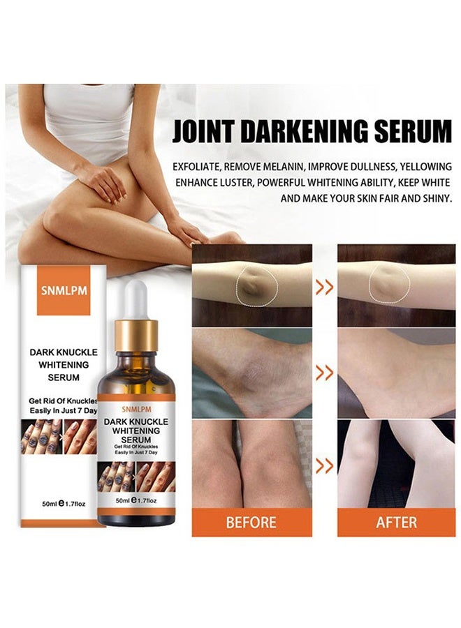 SNMLPM Dark Knuckle Whitening Serum, 7 Days Treatment For Dark Spots In Hand And Feet Knuckles Exfoliating Improves Dullness Powerful Whitening Effect For Men And Women 50ml - Image 2