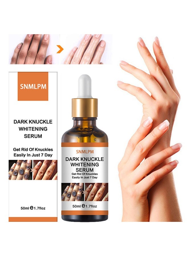 SNMLPM Dark Knuckle Whitening Serum, 7 Days Treatment For Dark Spots In Hand And Feet Knuckles Exfoliating Improves Dullness Powerful Whitening Effect For Men And Women 50ml - Image 1