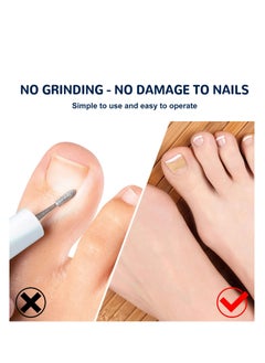 EELHOE Toenail Correction Patch 50 Pieces  - Image 3