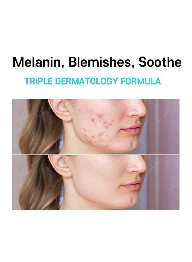 CARENEL Anti Melasma Cica Cream, Melasma Treatment For Face Cream, Dark Spot Remover Centella Asiatica, Skin Care Beauty Products - Image 2