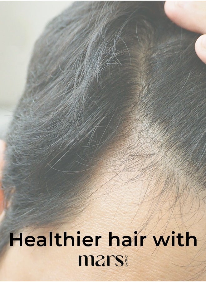 mars by GHC - Minoxidil Hair Growth Topical Solution USP 5% W/V for Men Hair Growth - 60ml - Hair Regrowth for Men - Image 1