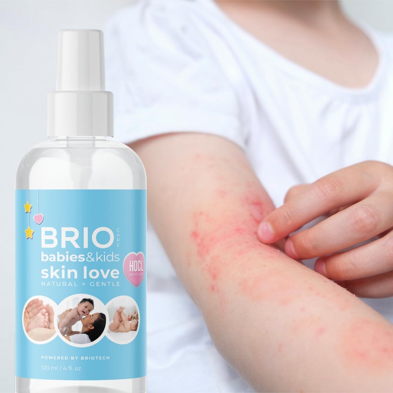 BRIOTECH Babies & Kids Skin Love Soothing Hypochlorous Acid Spray, Calm Redness & Bumps, Support Against Diaper Irritation, 4 fl oz - Image 5