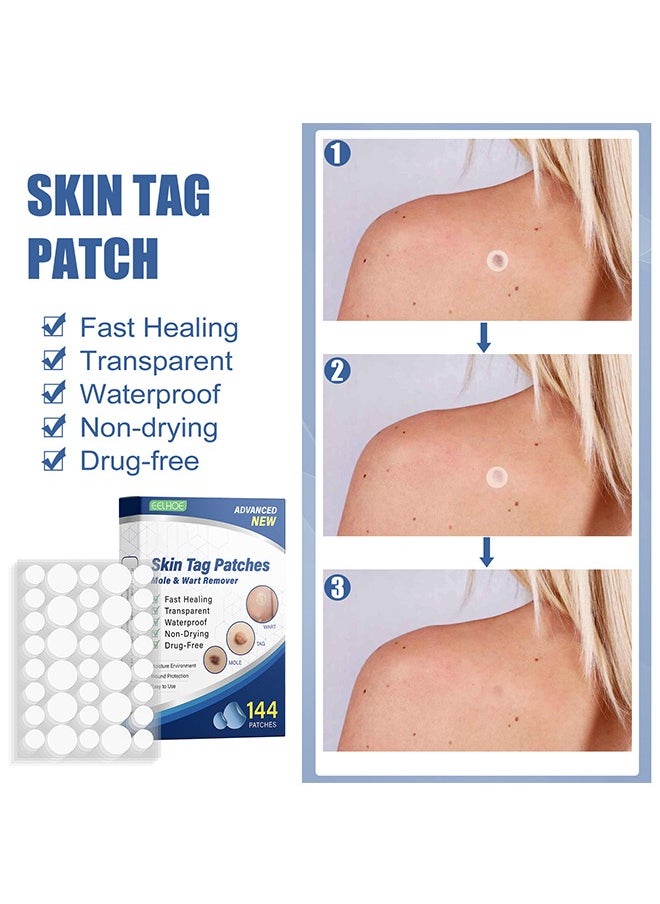 EELHOE - Skin Tag Remover Patches Mole Wart Removing Sticker Natural Ingredients 144 Pieces - Image 1