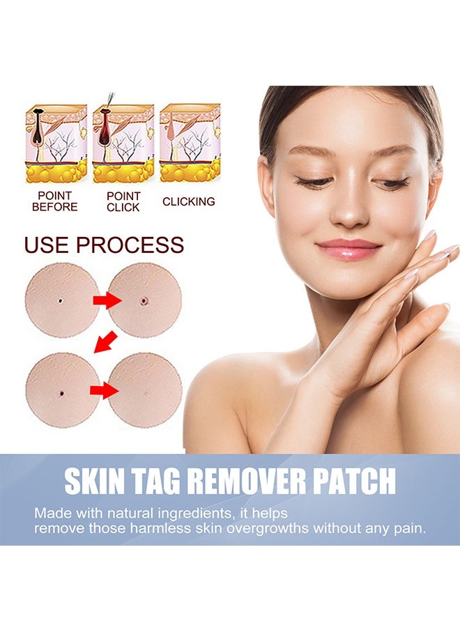 EELHOE - Skin Tag Remover Patches Mole Wart Removing Sticker Natural Ingredients 144 Pieces - Image 1