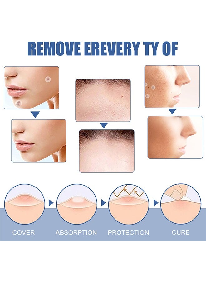 EELHOE - Skin Tag Remover Patches Mole Wart Removing Sticker Natural Ingredients 144 Pieces - Image 1