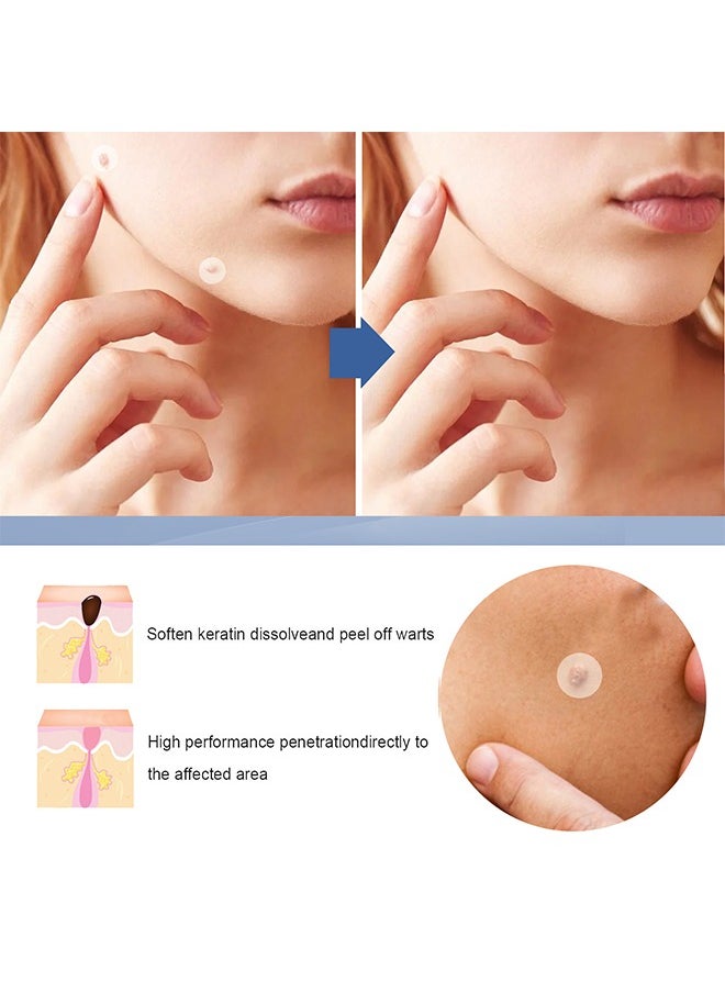 EELHOE - Skin Tag Remover Patches Mole Wart Removing Sticker Natural Ingredients 144 Pieces - Image 1