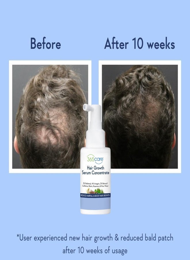 365 كير سيروم 365Care لنمو الشعر السريع | يعزز كثافة الشعر، ويقلل من تساقطه، مع 3% ريدينسيل، 4% أناجين، 2% بايكابيل، وماء الأرز، وسيروم متطور لنمو الشعر، للرجال والنساء، 50 مل - Image 2