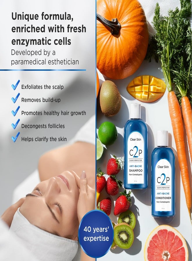 C2P Non-Comedogenic Conditioner by Clear 2 Perfection - Sulfate-Free & Paraben-Free - Ideal for Acne-Prone Skin & Bacne - Esthetician Formulated - Promotes Clear Skin & Healthy Hair - Image 4