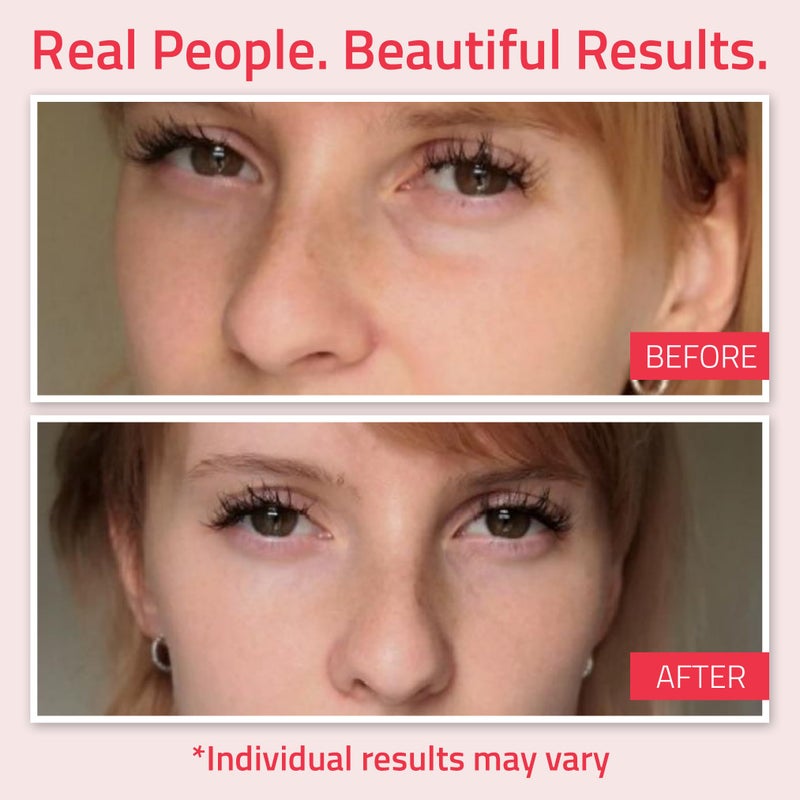 YEOUTH Retinol Eye Cream Anti Aging, Firming Under Eye Cream for Puffiness and Bags Under Eyes for Wrinkles and Dark Circles with Hyaluronic Acid and Tripeptides 1oz - Image 4