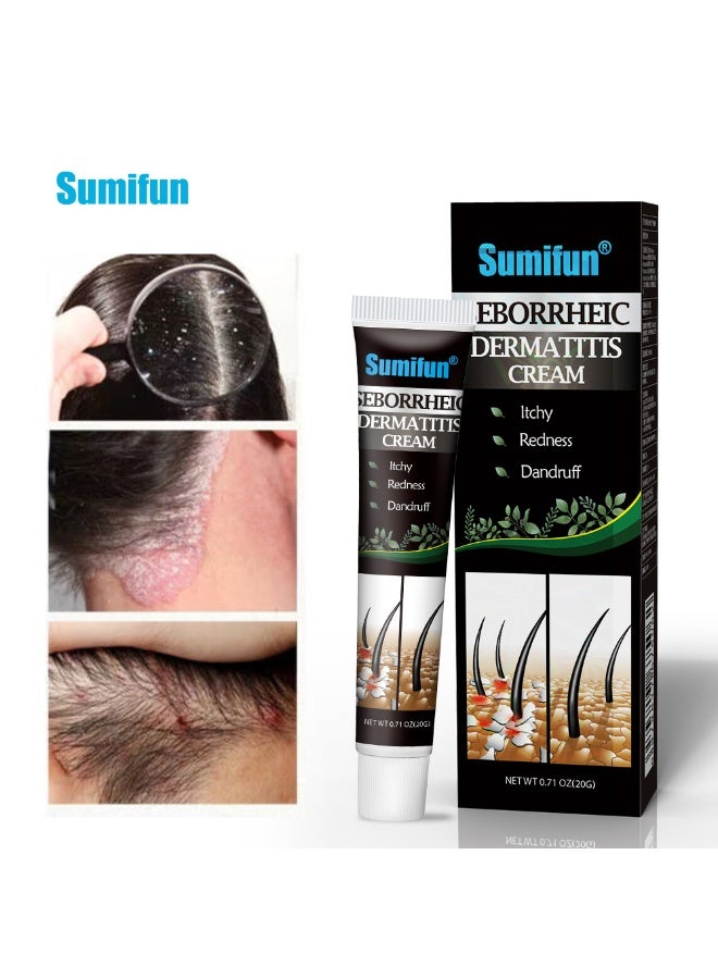 سوميفون كريم التهاب الجلد الدهني، لعلاج التهاب بصيلات الشعر والتهاب الجلد الدهني - يخفف الحكة وجفاف فروة الرأس - Image 2