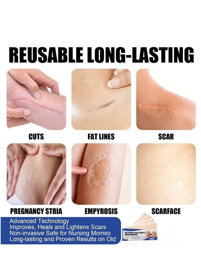 Generic - 4PCS Professional Silicone Scar Sheets,Soft Silicone Gel Scar Tape Painless Silicone Tape Roll Effective Silicone Scar Removal Strips Sheets for C-Section & Keloid Surgery, Burn, Acne - Image 1