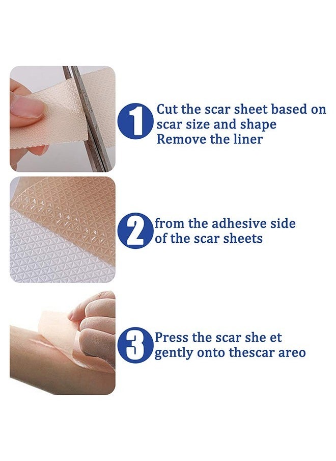 Generic - 4PCS Professional Silicone Scar Sheets,Soft Silicone Gel Scar Tape Painless Silicone Tape Roll Effective Silicone Scar Removal Strips Sheets for C-Section & Keloid Surgery, Burn, Acne - Image 1
