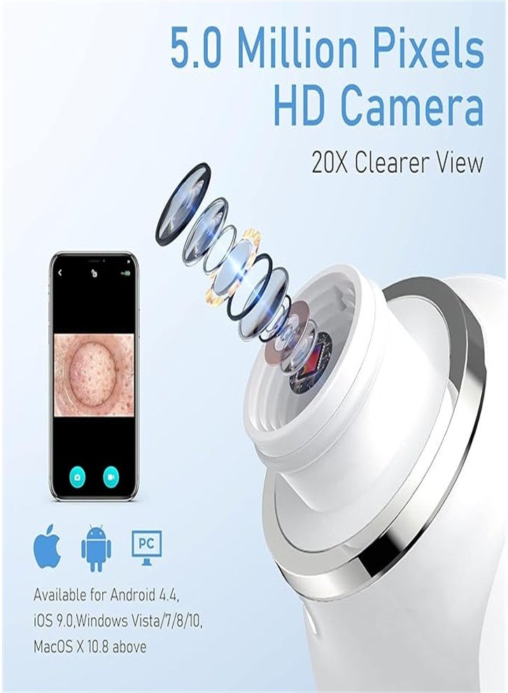 New Blackhead Remover, Pore Vacuum Cleaner, Blackhead Extraction Tool with Camera, Pore Cleaner for Men and Women, 3 Adjustment Modes and 6 Suction Heads (Pink) - Image 2